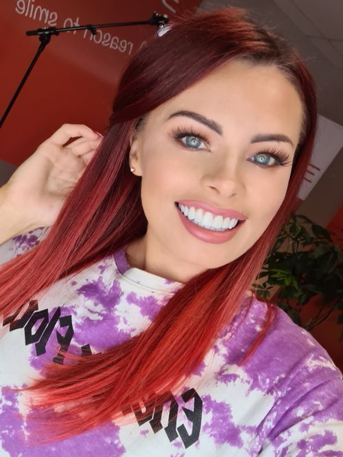 Porcelain veneers - 3Dental Dublin, Limerick & Galway